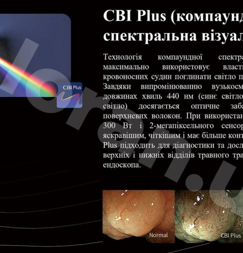 Гастростійка, ендоскопічна стійка для колоноскопії, стійка для бронхоскопії